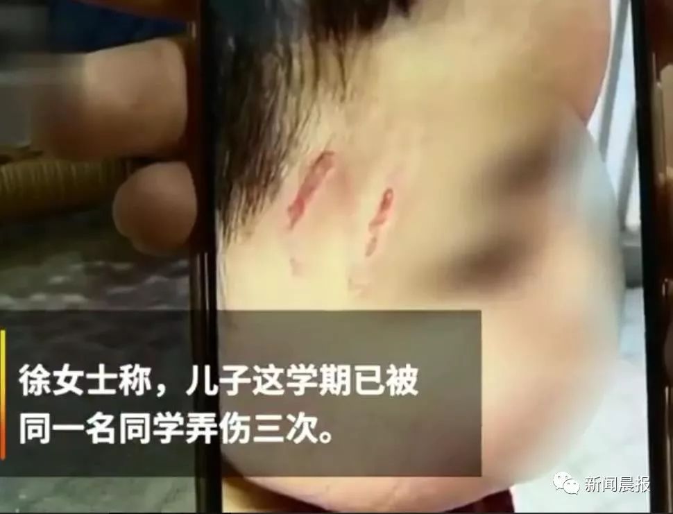“爸爸在这里,你敢不敢打回去?”娃在幼儿园被欺负受伤,家长一句话让网友炸了-武穆逸仙